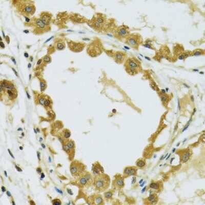 Immunohistochemistry-Paraffin: RPS7 Antibody [NBP2-94119] -  Human breast using RPS7 antibody at dilution of 1:100 (40x lens).Perform microwave antigen retrieval with 10 mM PBS buffer pH 7.2 before commencing with IHC staining protocol.