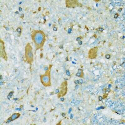 Immunohistochemistry-Paraffin: RPS7 Antibody [NBP2-94119] - Mouse spinal cord using RPS7 antibody at dilution of 1:100 (40x lens).Perform microwave antigen retrieval with 10 mM PBS buffer pH 7.2 before commencing with IHC staining protocol.