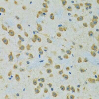 Immunohistochemistry-Paraffin: RPS7 Antibody [NBP2-94119] - Rat brain using RPS7 antibody at dilution of 1:100 (40x lens).Perform microwave antigen retrieval with 10 mM PBS buffer pH 7.2 before commencing with IHC staining protocol.