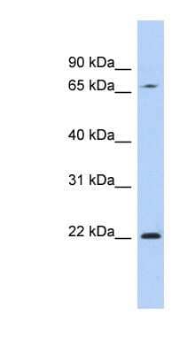 Western Blot: RPS7 Antibody [NBP1-57394] - Human Placenta lysate, concentration 0.2-1 ug/ml.