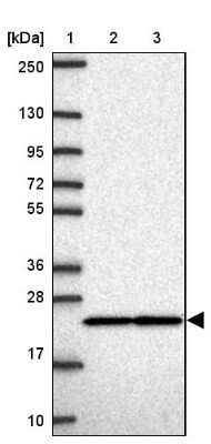 Western Blot: RPS7 Antibody [NBP2-33793] - Lane 1: Marker  [kDa] 250, 130, 95, 72, 55, 36, 28, 17, 10.  Lane 2: Human cell line RT-4.  Lane 3: Human cell line U-251MG sp