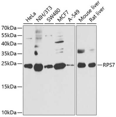 Western Blot: RPS7 Antibody [NBP2-94119] - Analysis of extracts of various cell lines, using RPS7 at 1:1000 dilution. Secondary antibody: HRP Goat Anti-Rabbit IgG (H+L) at 1:10000 dilution. Lysates/proteins: 25ug per lane. Blocking buffer: 3% nonfat dry milk in TBST. Detection: ECL Basic Kit . Exposure time: 90s.