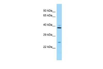 Western Blot: RPS8 Antibody [NBP2-86784] - Host: Rabbit. Target Name: Rps8. Sample Type: Mouse Testis lysates. Antibody Dilution: 1.0ug/ml