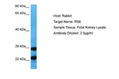 Western Blot: RPS8 Antibody [NBP2-86785] - Host: Rabbit. Target Name: RPS8. Sample Tissue: Human Fetal Kidney. Antibody Dilution: 1.0ug/ml