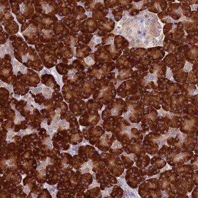 Immunohistochemistry-Paraffin: RPS9 Antibody [NBP2-13265] - Staining of human pancreas shows strong cytoplasmic positivity in exocrine glandular cells.