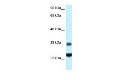 Western Blot: RPS9 Antibody [NBP2-88191] - WB Suggested Anti-RPS9 Antibody. Titration: 1.0 ug/ml. Positive Control: HepG2 Whole Cell