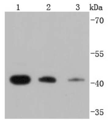 Western Blot: RPSA Antibody (JF0955) [NBP2-67117] - Analysis of RPSA on different lysates using anti-RPSA antibody at 1/1,000 dilution. Positive control: Lane 1: K562 Lane 2: HepG2 Lane 3: A431