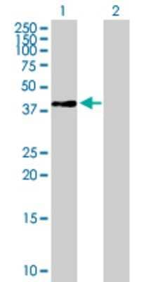 Western Blot: RPSAP58 Antibody [H00388524-B01P] - Analysis of LOC388524 expression in transfected 293T cell line by LOC388524 polyclonal antibody.  Lane 1: LOC388524 transfected lysate(32.45 KDa). Lane 2: Non-transfected lysate.