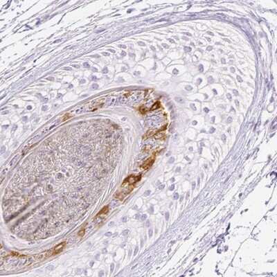 Immunohistochemistry-Paraffin: RPTN Antibody [NBP1-93792] - Staining of hair shows moderate cytoplasmic positivity in internal root sheath.