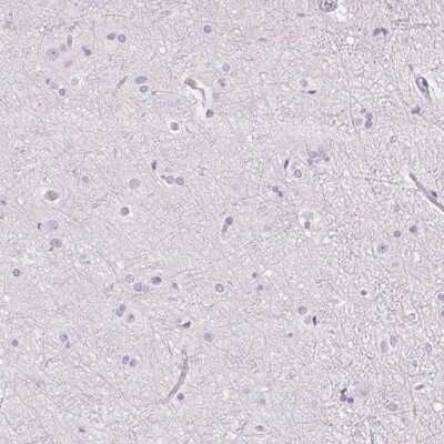 Immunohistochemistry-Paraffin: RPTN Antibody [NBP1-93792] - Staining of human cerebral cortex shows low expression as expected.