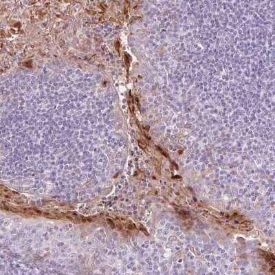 Immunohistochemistry-Paraffin: RPTN Antibody [NBP1-93792] - Staining of human tonsil shows high expression.