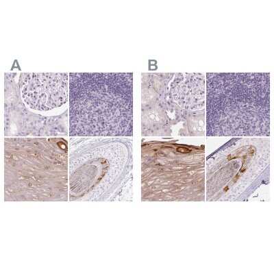 <b>Independent Antibodies Validation and Orthogonal Strategies Validation.</b>Immunohistochemistry-Paraffin: RPTN Antibody [NBP1-93792] - Staining of human kidney, lymph node, skin and skin, hairy using Anti-RPTN antibody NBP1-93792 (A) shows similar protein distribution across tissues to independent antibody NBP2-38159 (B).