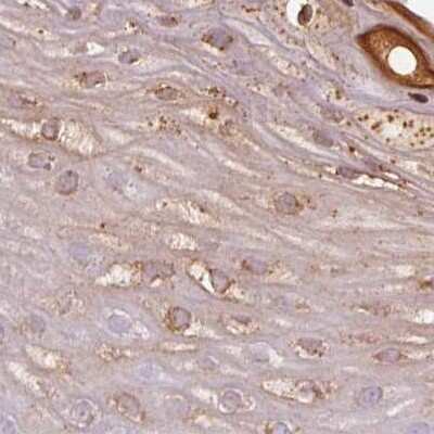 Immunohistochemistry-Paraffin: RPTN Antibody [NBP1-93792] - Staining of human skin.