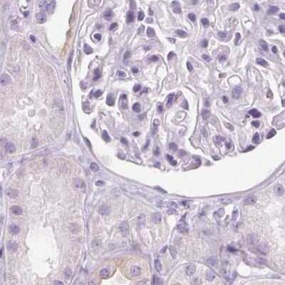 Immunohistochemistry-Paraffin: RPTN Antibody [NBP1-93792] - Staining of human kidney.