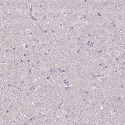 Immunohistochemistry-Paraffin: RPTN Antibody [NBP2-38159] - Staining of human cerebral cortex shows low expression as expected.