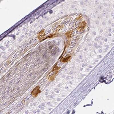Immunohistochemistry-Paraffin: RPTN Antibody [NBP2-38159] - Staining of human hair shows moderate cytoplasmic positivity in a subset of cells in internal root sheath.