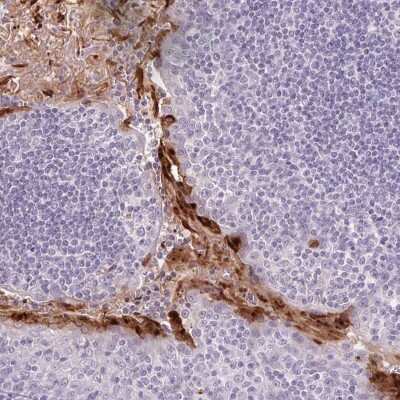Immunohistochemistry-Paraffin: RPTN Antibody [NBP2-38159] - Staining of human tonsil shows high expression.
