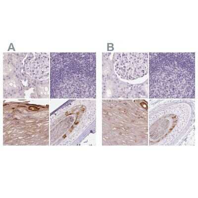 Immunohistochemistry-Paraffin: RPTN Antibody [NBP2-38159] - Staining of human kidney, lymph node, skin and skin, hairy using Anti-RPTN antibody NBP2-38159 (A) shows similar protein distribution across tissues to independent antibody NBP1-93792 (B).