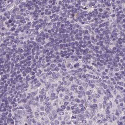 Immunohistochemistry-Paraffin: RPTN Antibody [NBP2-38159] - Staining of human lymph node.