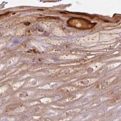 Immunohistochemistry-Paraffin: RPTN Antibody [NBP2-38159] - Staining of human skin.