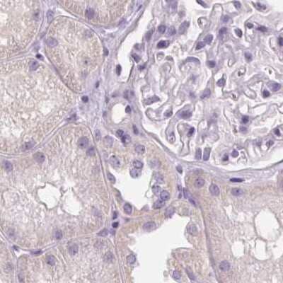 Immunohistochemistry-Paraffin: RPTN Antibody [NBP2-38159] - Staining of human kidney.