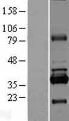 Western Blot: RPUSD1 Overexpression Lysate (Adult Normal) [NBL1-15580] Left-Empty vector transfected control cell lysate (HEK293 cell lysate); Right -Over-expression Lysate for RPUSD1.