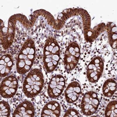 Immunohistochemistry-Paraffin RPUSD2 Antibody - BSA Free