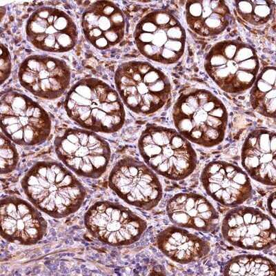 Immunohistochemistry-Paraffin: RPUSD2 Antibody [NBP1-88438] - Staining of human rectum shows strong cytoplasmic positivity in glandular cells.