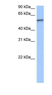 Western Blot: RPUSD2 Antibody [NBP1-80476] - Jurkat cell lysate, concentration 0.2-1 ug/ml.
