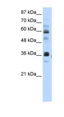 Western Blot: RPUSD2 Antibody [NBP1-80477] - Titration: 5.0ug/ml Positive Control: HepG2 cell lysate.