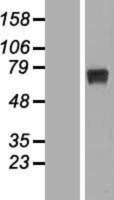 Western Blot: RPUSD2 Overexpression Lysate (Adult Normal) [NBL1-15581] Left-Empty vector transfected control cell lysate (HEK293 cell lysate); Right -Over-expression Lysate for RPUSD2.