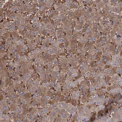 Immunohistochemistry RPUSD3 Antibody - BSA Free