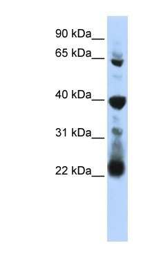 Western Blot: RPUSD3 Antibody [NBP1-80483] - Titration: 0.2-1 ug/ml, Positive Control: 721_B cell lysate.