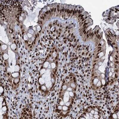 Immunohistochemistry-Paraffin: RPUSD4 Antibody [NBP1-82231] - Staining of human rectum shows strong nuclear positivity in glandular cells.