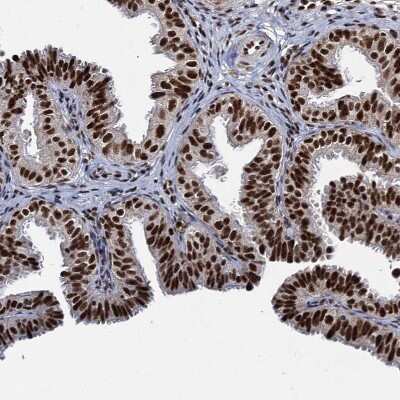 Immunohistochemistry-Paraffin: RPUSD4 Antibody [NBP1-82231] - Staining of human fallopian tube shows strong nuclear positivity in glandular cells.