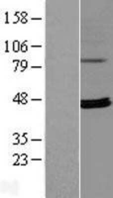 Western Blot: RPUSD4 Overexpression Lysate (Adult Normal) [NBL1-15583] Left-Empty vector transfected control cell lysate (HEK293 cell lysate); Right -Over-expression Lysate for RPUSD4.