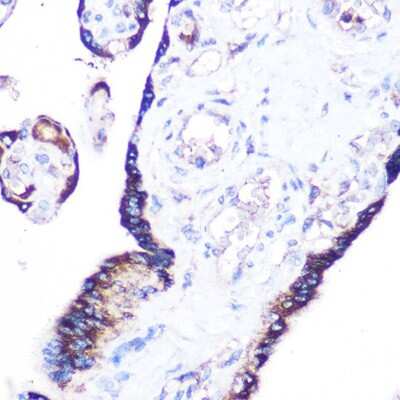 Immunohistochemistry-Paraffin: RRAGA Antibody [NBP2-94546] - Immunohistochemistry of paraffin-embedded human placenta using RRAGA Rabbit pAb (NBP2-94546) at dilution of 1:100 (40x lens). Perform microwave antigen retrieval with 10 mM Tris/EDTA buffer pH 9.0 before commencing with IHC staining protocol.