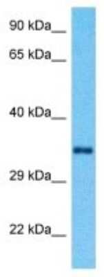 Western Blot: RRAGA Antibody [NBP3-09951] - Western blot analysis of RRAGA in Fetal Lung lysates. Antibody dilution at 1ug/ml