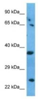 Western Blot: RRAGA Antibody [NBP3-09997] - Western blot analysis of RRAGA in Human 786-0 Whole Cell. Antibody dilution at 1.0ug/ml