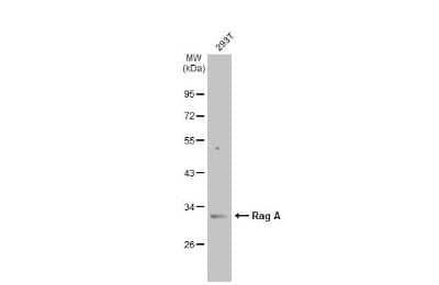 Western Blot: RRAGA Antibody [NBP3-13446] - Whole cell extract (30 ug) was separated by 10% SDS-PAGE, and the membrane was blotted with RRAGA antibody (NBP3-13446) diluted at 1:5000. The HRP-conjugated anti-rabbit IgG antibody (NBP2-19301) was used to detect the primary antibody.