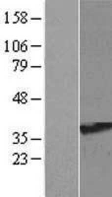 Western Blot: RRAGA Overexpression Lysate (Adult Normal) [NBL1-15585] Left-Empty vector transfected control cell lysate (HEK293 cell lysate); Right -Over-expression Lysate for RRAGA.