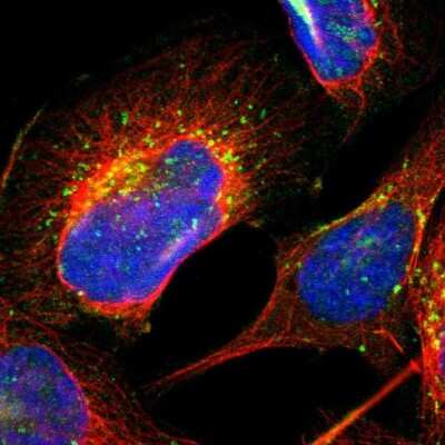 Immunocytochemistry/ Immunofluorescence RRAGB Antibody