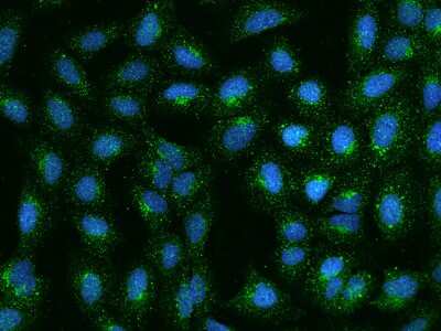 Immunocytochemistry/ Immunofluorescence RRAGB Antibody