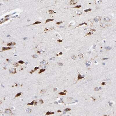 Immunohistochemistry-Paraffin RRAGB Antibody