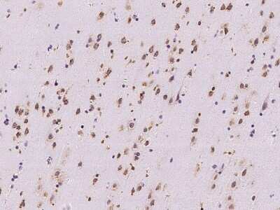 Immunohistochemistry-Paraffin: RRAGB Antibody [NBP2-97877] - Immunochemical staining of human RRAGB in human brain with rabbit polyclonal antibody at 1:500 dilution, formalin-fixed paraffin embedded sections.