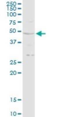 Western Blot: RRAGB Antibody [H00010325-D01P] - Analysis of RRAGB expression in A-431.