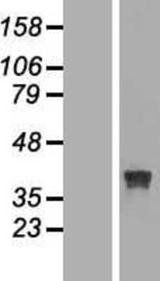 Western Blot RRAGB Overexpression Lysate