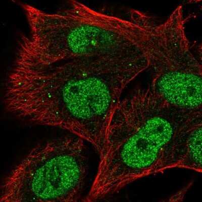 Immunocytochemistry/Immunofluorescence: RRAGD Antibody [NBP2-55736] - Staining of human cell line SK-MEL-30 shows localization to nucleoplasm & centrosome. Antibody staining is shown in green.