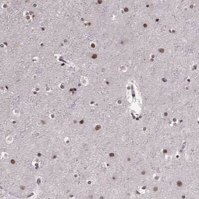 Immunohistochemistry-Paraffin: RRAGD Antibody [NBP2-55736] - Staining of human cerebral cortex shows nuclear positivity in neuronal and glial cells.