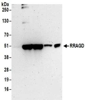 Western Blot RRAGD Antibody